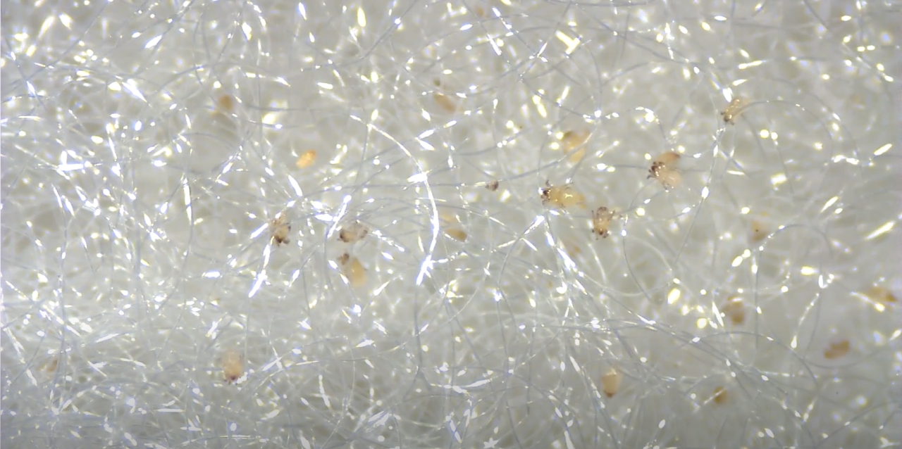 顕微鏡で見た布団の中のダニ