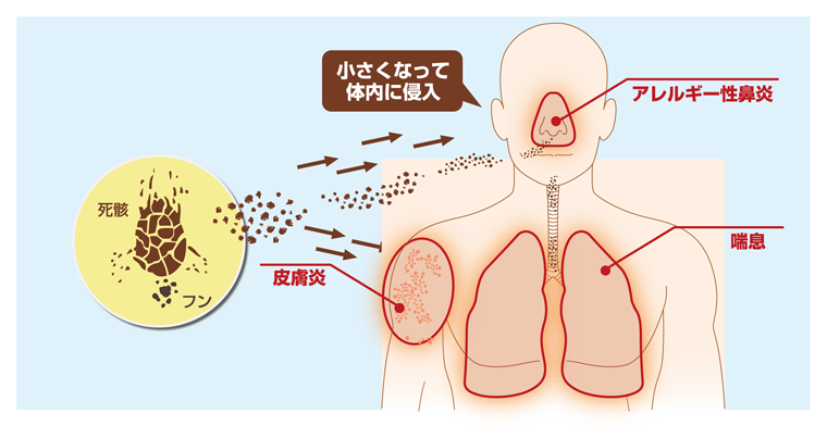 ダニアレルゲンとアレルギー性疾患