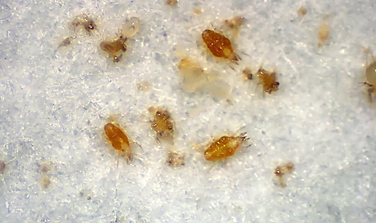 人を刺す！ツメダニの見た目と特徴