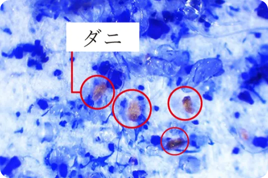 実際に捕獲されたダニの姿